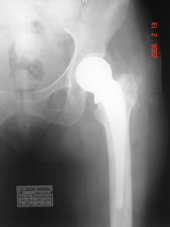 coimbatore-orthopaedic-joint-replacement-maternity-child-welfare-centre-india